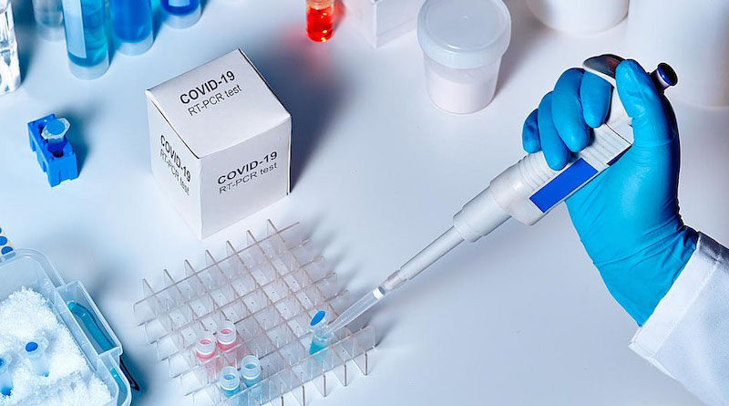 Безкоштовно аналіз на COVID-19 можна здати за направленням лікаря у 71 пункті тестування.